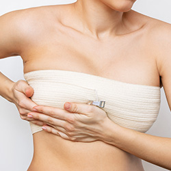 Breast Implant Removal in Beverly Hills, CA